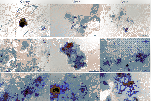 Microplastics as seen in the body